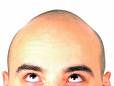 bald-man