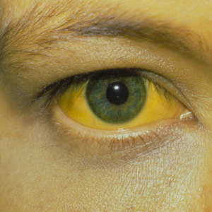 yellow eyes 2