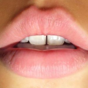 woman-lips-3