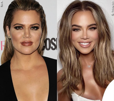 Khloe Kardashian says judgment over her body is 'almost unbearable